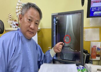 夫妻打架老公不敵送急診　醫師告訴患者太太「神來一腿」查出竟骨內囊腫