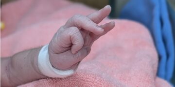32週早產兒雙腳先露命懸一線 安泰醫院跨團隊接力搶救母子均安