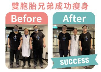 胃繞道手術見成效 雙胞胎兄弟減重40公斤重拾健康