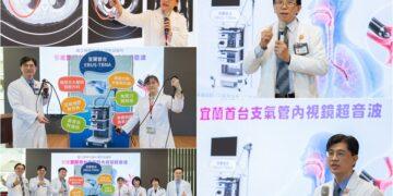 增添診斷肺癌新利器　陽明交大醫院引進支氣管內視鏡超音波