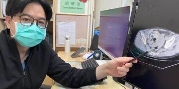 工地意外僅喊腿痛 檢查竟是腸系膜大出血 急診醫師揭「姿勢痛」致命警訊