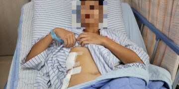 高三生發燒嘔吐以為感冒 轉診發現竟肝臟竟藏8公分膿瘍