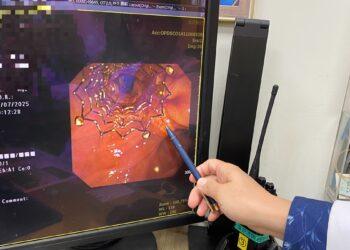 罹癌婦人發燒、噁心送急診 醫師發現因膽管道塑膠支架阻塞引起