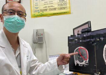 原要換膝關節竟變「緊急開腦」 員榮跨科團隊及時攔截隱形殺手
